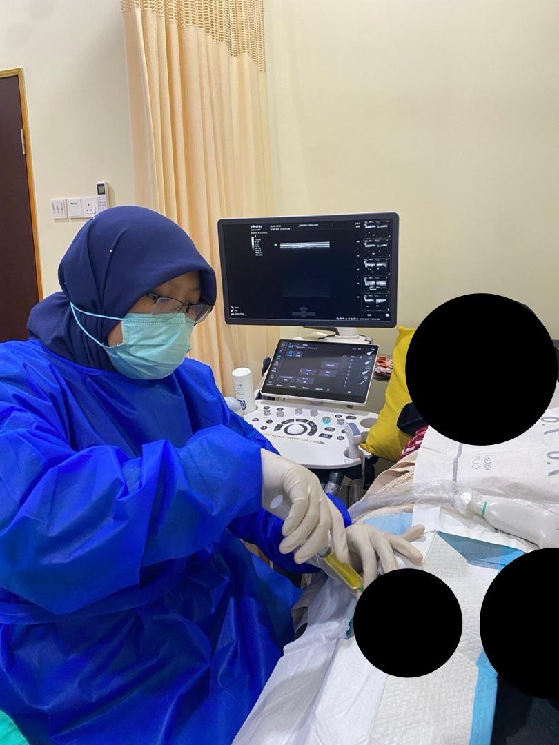 rawatan baker's cyst