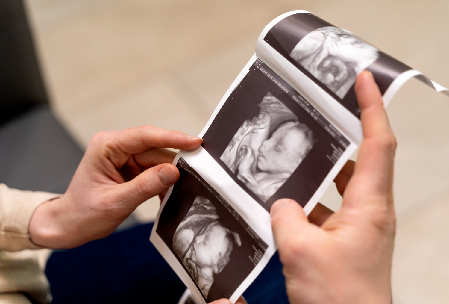 Scan Jantina Baby: Panduan, Waktu Sesuai & Tips Tepat